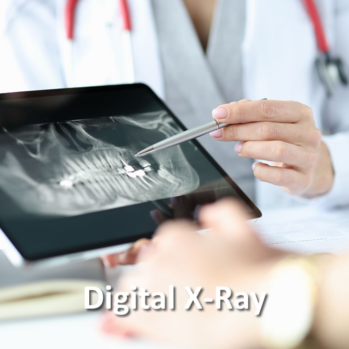 Dental Digital X-Ray | Advanced Technology | Santa Rosa