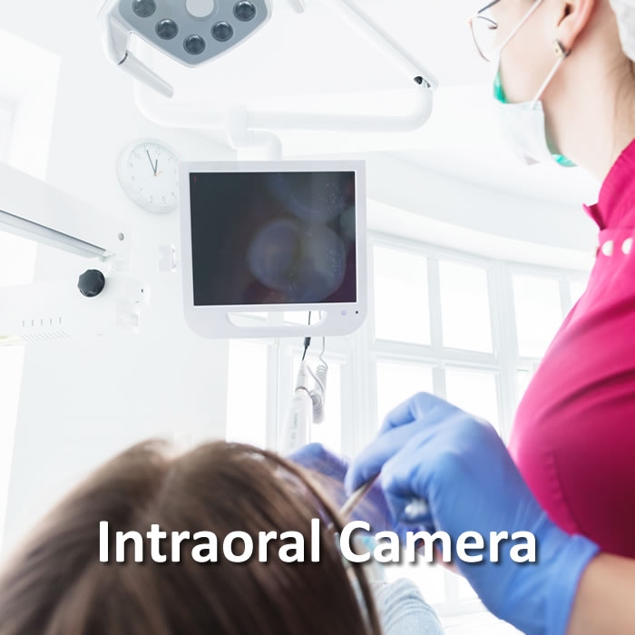 Intraoral Camera | Advanced Technology | Santa Rosa