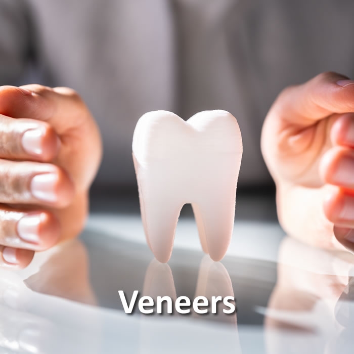 Veneers | Cosmetic Dentistry | Santa Rosa