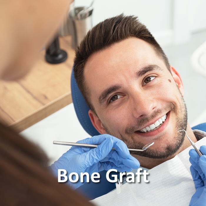 Bone Graft | Dental Restorative | Santa Rosa