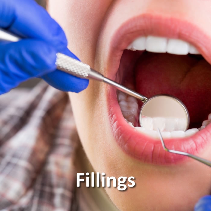 Fillings | Dental Restorative | Santa Rosa